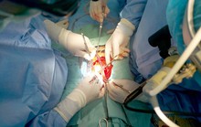 Nhiều người chấn thương động mạch chủ được cứu sống nhờ phẫu thuật HYBRID