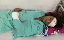 Cấm nuôi chó dữ, được không?