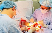 Nối thành công bàn tay người đàn ông bị đứt lìa do tai nạn lao động