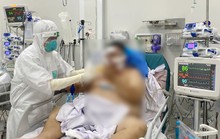 TP HCM: Cứu sống 2 bệnh nhân Covid-19 nguy kịch