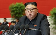 Tình báo Hàn Quốc: Ông Kim Jong-un sụt 10-20 kg