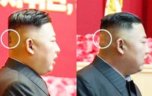 Ông Kim Jong-un bất ngờ xuất hiện với băng dán sau đầu