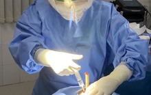 Cứu sống bệnh nhân bị cây tre đâm hốc mắt xuyên sàn sọ phù dập não
