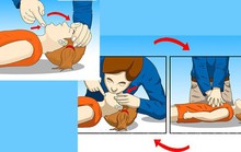 Trẻ đuối nước: Tuyệt đối không vác chạy, dốc ngược