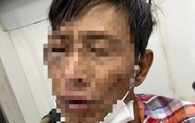 Người đàn ông nhiễm HIV đâm trọng thương người dân, vung rìu chống trả công an