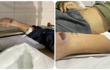 Bắt cựu đội trưởng, đội phó công an huyện vì dùng nhục hình