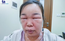 Sau thoa mỹ phẩm, người phụ nữ phải đi xe lăn