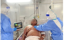 Gần 3 tháng cứu chàng trai cân nặng 140 kg mắc Covid-19