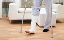 Nam thanh niên bị đánh ghen gãy chân khi đứng nói chuyện với vợ người khác