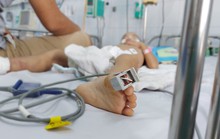 Sốt xuất huyết phức tạp, các bệnh viện ở TP HCM đồng loạt tập huấn điều trị