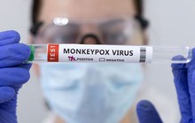 Mỹ thử nghiệm thuốc điều trị đậu mùa khỉ