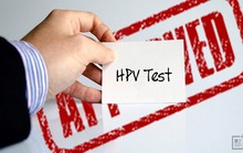 Nữ giới dưới 30 tuổi có nên xét nghiệm HPV?