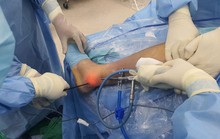 Nhập viện vì tập sai cách