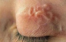 Dễ lây nhiễm giun sán từ thú cưng