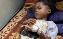 Sau khi ăn thịt cóc mẹ làm, 2 bé ngộ độc, 1 bé tử vong