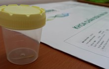 Vào viện cấp cứu mới biết đã nuốt phải mẩu xương dài 5 cm