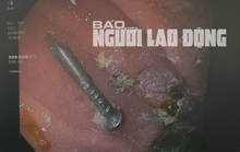 Bé trai gặp nguy hiểm khi nuốt cây đinh lúc đang chơi đùa