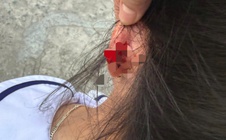 Xác minh vụ cô giáo ở Phú Quốc nhéo tai học sinh lớp 1 đến chảy máu