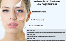 Hành trình phục hồi da sau sinh – dễ bắt đầu hơn mẹ nghĩ