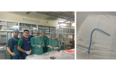 Ống thông truyền hóa chất bị bỏ quên suốt 3 năm, đứt trôi vào tim người phụ nữ