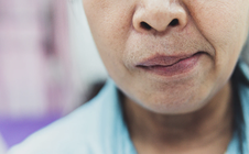 Mưa gió, nhiều người ngủ dậy bỗng méo miệng