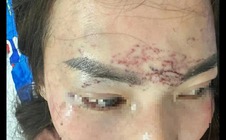 Khởi tố vụ bắt người phụ nữ đem về xăm, cắt tóc và đánh đập gây chấn động dư luận ở Cà Mau