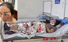 Làm rõ việc tiểu thương tố bị hành hung
