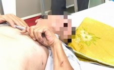 Nam tài xế nguy kịch vì bị chó cắn