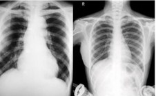 Vướng mắc thanh toán X-quang dưới 6 phút, BHXH Việt Nam lên tiếng