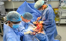 Bác sĩ TP HCM "giành lại" đôi chân cho thầy giáo Campuchia