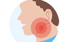 Thiếu niên 15 tuổi hóc hạt hạnh nhân trong phế quản 7 ngày