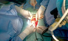 Nhiều người chấn thương động mạch chủ được cứu sống nhờ phẫu thuật HYBRID