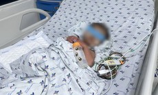 Bé trai nguy kịch sau cơn sốt bởi căn bệnh thường gặp