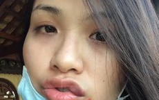 Diễm Hương lo sợ sau khi tố cáo "bị chồng hành hung"