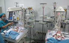 Một bé gái song sinh dính liền tiến triển tốt