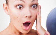 Làm gì khi bị dị ứng mỹ phẩm?