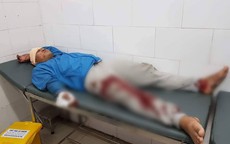 Truy đuổi, bị trộm chó đạp trọng thương