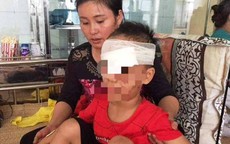 Chó nhà bất ngờ cắn nát vùng mặt bé trai 6 tuổi