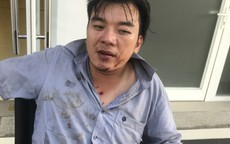 Khách tố bị nhân viên nhà hàng đánh bầm dập vì yêu cầu in hóa đơn đỏ
