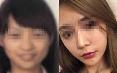 Cô gái bị lỡ chuyến bay vì khuôn mặt khác lạ sau phẫu thuật thẩm mỹ