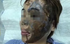 Lần đầu tiên tạo hình "tươi" cho cô gái bị tạt axít