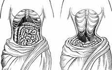 Thời trang nguy hiểm thời xưa