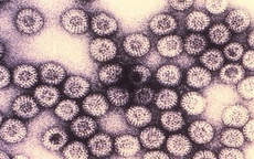 9 virus nguy hiểm trên trái đất