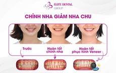 Hành trình sở hữu nụ cười khỏe đẹp toàn diện có gian nan không?