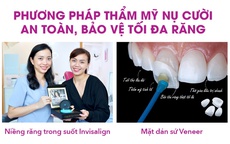 3 điều bạn cần biết để làm đẹp nụ cười an toàn