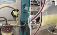 Kỳ lạ người phụ nữ có máu đục như sữa