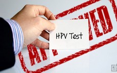 Nữ giới dưới 30 tuổi có nên xét nghiệm HPV?