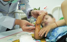 Chợ Rẫy kích hoạt báo động đỏ nối bàn tay đứt lìa