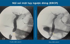 Bác sĩ "cân não" với ca bệnh 25 năm mới gặp trong nghề