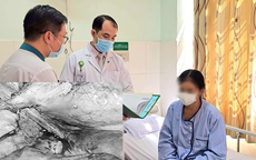 Nữ bệnh nhân mắc chứng bệnh hiếm gặp, đi tiểu ra những sợi tóc
